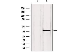 Western Blotting (WB) image for anti-CCAAT/enhancer Binding Protein (C/EBP), beta (CEBPB) (Internal Region) antibody (ABIN6260349)