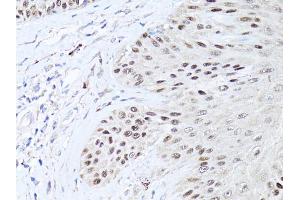 Immunohistochemistry of paraffin-embedded human skin using TP63 antibody (ABIN5971164) at dilution of 1:50 (40x lens). (p63 抗体)