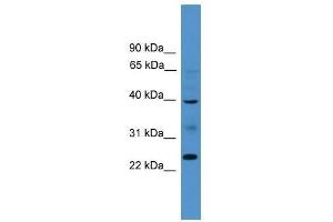 BTNL8 antibody used at 0. (BTNL8 抗体  (Middle Region))