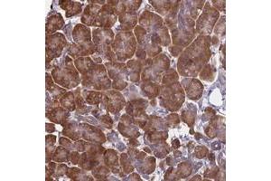 Immunohistochemical staining of human pancreas with KIAA1143 polyclonal antibody  shows strong cytoplasmic positivity in exocrine glandular cells at 1:1000-1:2500 dilution. (KIAA1143 抗体)
