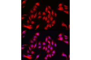 Immunofluorescence analysis of U2OS cells using Annexin  Rabbit pAb (ABIN6127436, ABIN6136920, ABIN6136921 and ABIN6223291) at dilution of 1:50 (40x lens). (Annexin A11 抗体  (AA 276-505))