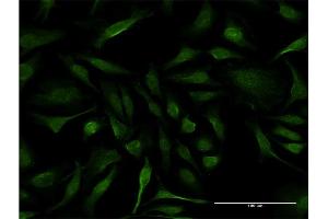 Immunofluorescence of monoclonal antibody to IFT20 on HeLa cell. (IFT20 抗体  (AA 1-148))