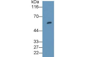 Detection of PKBb in Rat Thyroid lysate using Polyclonal Antibody to Protein Kinase B Beta (PKBb) (AKT2 抗体  (AA 142-412))