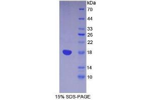 SDS-PAGE analysis of Mouse Lymphocyte Antigen 96 Protein. (LY96 蛋白)