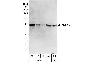 Western Blotting (WB) image for anti-Zinc Finger Protein 148 (ZNF148) (AA 744-794) antibody (ABIN7453249)