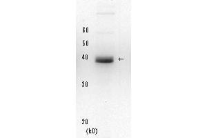 Western Blotting (WB) image for anti-Xeroderma Pigmentosum, Complementation Group A (XPA) (full length) antibody (ABIN3200998) (XPA 抗体  (full length))