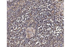 IHC analysis of PSMD8 using anti-PSMD8 antibody (ABIN7602571).