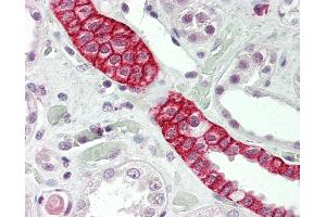 Human Kidney: Formalin-Fixed, Paraffin-Embedded (FFPE)
