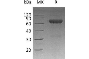 MMP12 Protein (His tag)
