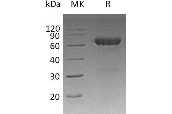 MMP12 Protein (His tag)