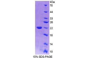 SDS-PAGE analysis of Mouse TRERF1 Protein. (TRERF1 蛋白)
