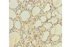 Immunohistochemistry of paraffin-embedded human thyroid tissue using ABIN7154959 at dilution of 1:100 (HEBP2 抗体  (AA 2-205))