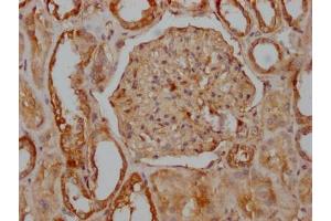 IHC image of ABIN7127577 diluted at 1:100 and staining in paraffin-embedded human kidney tissue performed on a Leica BondTM system. (Recombinant CD51 抗体)