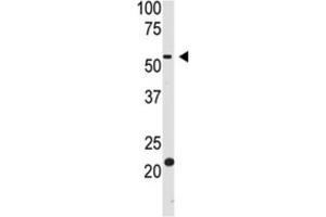 Western Blotting (WB) image for anti-beta-Site APP-Cleaving Enzyme 2 (BACE2) antibody (ABIN3002512)