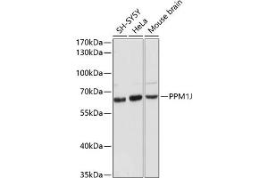Western blot analysis of extracts of various cell lines, using PPM1J antibody (ABIN6132509, ABIN6146046, ABIN6146047 and ABIN6216619) at 1:3000 dilution. (PPM1J 抗体  (AA 130-260))