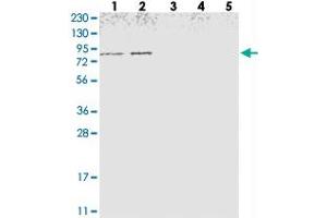 Western blot analysis of Lane 1: RT-4, Lane 2: U-251 MG, Lane 3: Human Plasma, Lane 4: Liver, Lane 5: Tonsil with NOL11 polyclonal antibody  at 1:250-1:500 dilution. (NOL11 抗体)