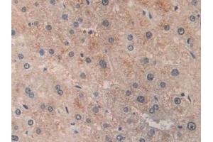 Detection of ACAT2 in Human Liver Tissue using Polyclonal Antibody to Acetyl Coenzyme A Acetyltransferase 2 (ACAT2) (ACAT2 抗体  (AA 1-397))