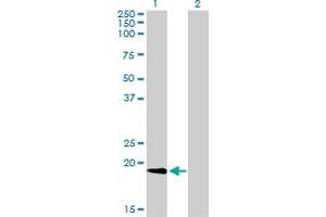 Western Blotting (WB) image for anti-Non-Metastatic Cells 1, Protein (NM23A) Expressed in (NME1) (AA 1-152) antibody (ABIN562003)