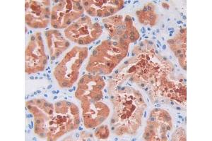Used in DAB staining on fromalin fixed paraffin- embedded Kidney tissue (UXT 抗体  (AA 15-157))