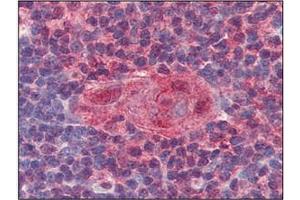 Immunohistochemistry (IHC) image for anti-Uracil-DNA Glycosylase (UNG) (AA 1-313), (N-Term) antibody (ABIN317576) (UNG 抗体  (N-Term))