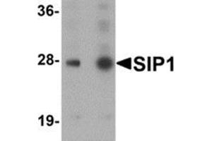 Western blot analysis of SIP1 in HeLa cell lysate with SIP1 antibody at (A) 0. (SIP1 抗体  (C-Term))