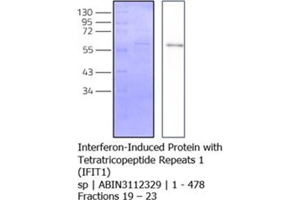IFIT1 Protein (AA 1-478) (His tag)