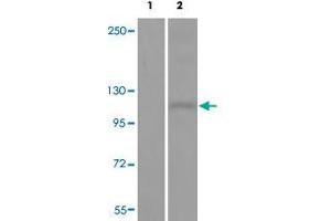 Western blot analysis of Lane 1: antigen-specific peptide treated JK cells, Lane 2: JK cells with DDR1 (phospho Y513) polyclonal antibody  at 1:500-1000 dilution. (DDR1 抗体  (pTyr513))