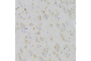 Immunohistochemistry of paraffin-embedded mouse brain using MAP2K5 Antibody (ABIN5974181) at dilution of 1/100 (40x lens). (MAP2K5 抗体)