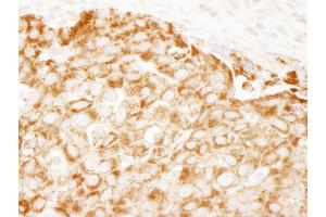 Immunohistochemistry (IHC) image for anti-Insulin Receptor Substrate 1 (IRS1) (AA 1192-1242) antibody (ABIN7453482)