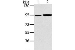 Western Blot analysis of 231 and PC3 cell using PYGL Polyclonal Antibody at dilution of 1:400 (PYGL 抗体)