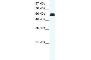 WB Suggested Anti-DDX27 Antibody Titration:  0. (DDX27 抗体  (N-Term))