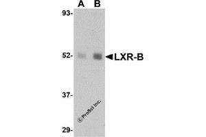 Western Blotting (WB) image for anti-Nuclear Receptor Subfamily 1, Group H, Member 2 (NR1H2) (N-Term) antibody (ABIN1031444) (NR1H2 抗体  (N-Term))