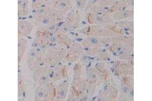 IHC-P analysis of Kidney tissue, with DAB staining. (ADCY7 抗体  (AA 309-491))