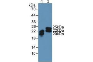 Western blot analysis of (1) Human SW480 Cells and (2) Human Urine. (Lipocalin 2 抗体  (AA 21-198))