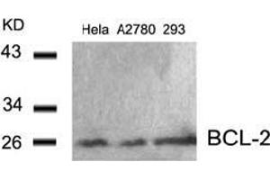 Image no. 3 for anti-B-Cell CLL/lymphoma 2 (BCL2) (AA 54-58) antibody (ABIN197202) (Bcl-2 抗体  (AA 54-58))