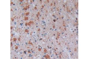 Used in DAB staining on fromalin fixed paraffin- embedded glioma tissue (CD1e 抗体  (AA 39-276))