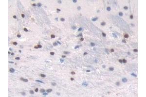 Detection of TALDO1 in Mouse Cerebrum Tissue using Polyclonal Antibody to Transaldolase (TALDO1) (TALDO1 抗体  (AA 35-285))