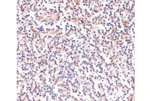 Immunohistochemistry (Paraffin-embedded Sections) (IHC (p)) image for anti-phosphoprotein Enriched in Astrocytes 15 (PEA15) (pSer104) antibody (ABIN7265284)