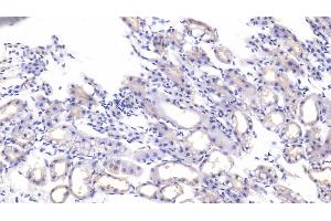 Detection of HDAC6 in Mouse Kidney Tissue using Polyclonal Antibody to Histone Deacetylase 6 (HDAC6) (HDAC6 抗体  (AA 560-811))