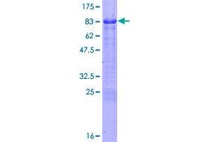 FEZ1 Protein (AA 1-392) (GST tag)