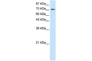 WB Suggested Anti-ZBTB48 Antibody Titration:  0. (ZBTB48 抗体  (N-Term))