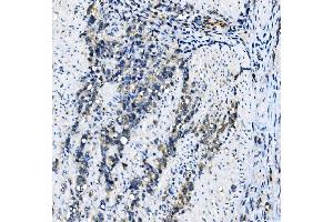 IHC analysis of EIF4A1 using anti-EIF4A1 antibody (ABIN7603143).