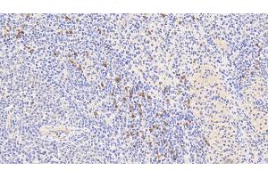 Detection of S100A9 in Human Spleen Tissue using Polyclonal Antibody to S100 Calcium Binding Protein A9 (S100A9) (S100A9 抗体  (AA 1-114))
