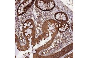 Immunohistochemical staining of human colon with MARK4 polyclonal antibody  shows moderate cytoplasmic positivity in glandular cells.