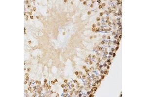 Immunohistochemistry (Paraffin-embedded Sections) (IHC (p)) image for anti-Histone 3 (H3) (H3K9me2) antibody (ABIN3023260)