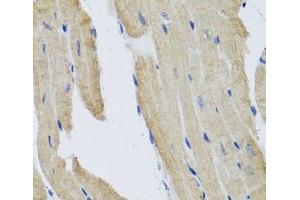 Immunohistochemistry of paraffin-embedded Mouse heart using PRPH Polyclonal Antibody at dilution of 1:100 (40x lens). (Peripherin 抗体)