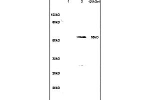 L1 human colon carcinoma lysates L2 rat brain lysates probed with Anti- WT-1/Wilms Tumor Protein Polyclonal Antibody, Unconjugated (ABIN1386293) at 1:200 in 4 °C. (WT1 抗体  (AA 301-400))