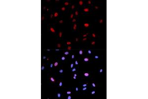 Immunofluorescence analysis of U2OS cells using Phospho-MAP2K6-S207/MAP2K3-S189 antibody (ABIN5969926). (MAP2K6 抗体  (pSer207))