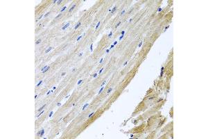 Immunohistochemistry of paraffin-embedded rat heart using PRPH antibody (ABIN5972212) at dilution of 1/100 (40x lens). (Peripherin 抗体)