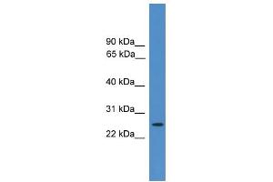 WB Suggested Anti-EIF4E2 Antibody Titration: 0. (EIF4E2 抗体  (N-Term))